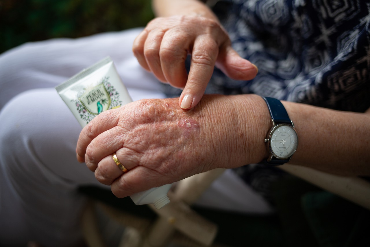 arthritis care in an older persons hands